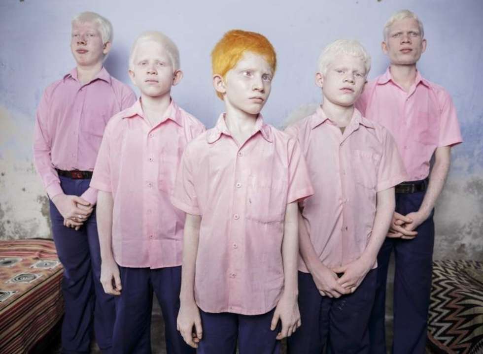  1st Prize People &#8211; Staged Portraits Single    25 September 2013, West Bengal India  A group of blind albino boys photographed in their boarding room at the Vivekananda mission school for the blind in West Bengal, India. This is one of the very few schools for the blind in India today.