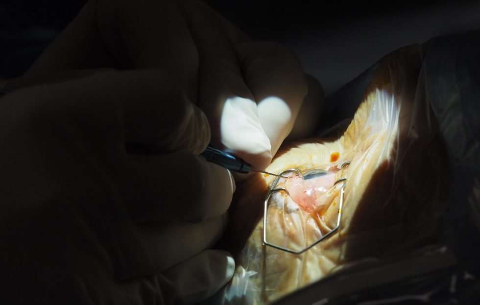  Transmisja operacji oka (zdjęcie 19) - Autor: Wojciech Nieśpiałowski
