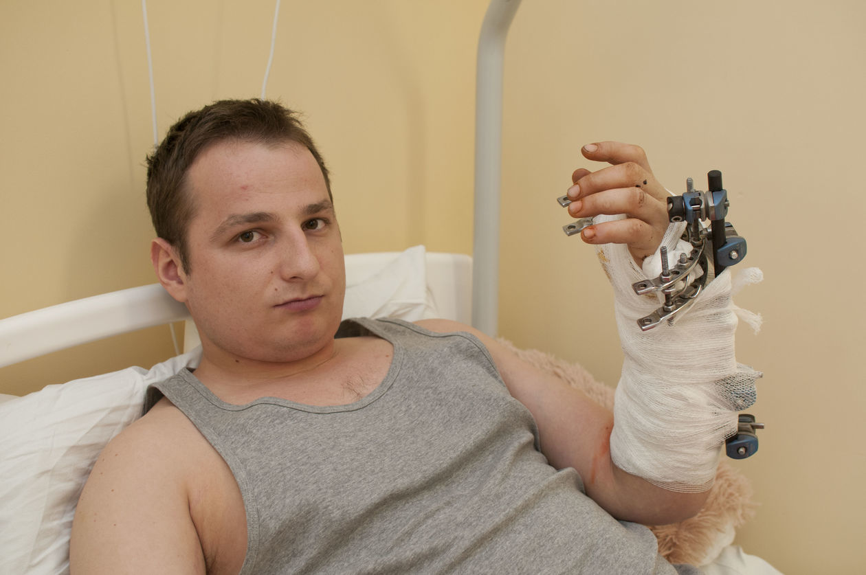  Lekarze z Łęcznej uratowali mu rękę (zdjęcie 1) - Autor: WCLOiChR w Łęcznej