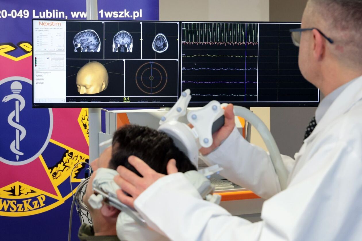  Prezentacja sprzętu do mapowania mózgu w 1 Wojskowym Szpitalu Klinicznym  - Autor: DW