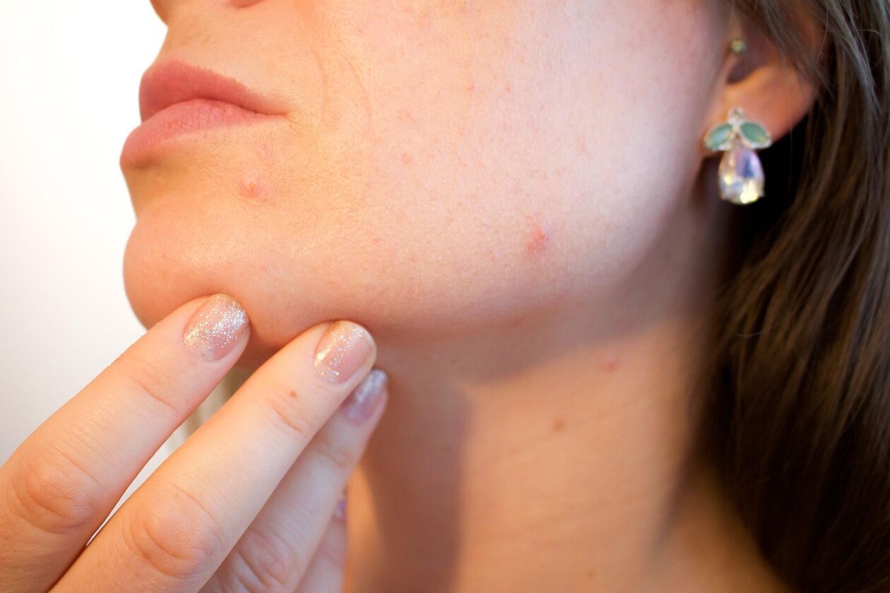 <p>Dermatolog nie zajmuje się tylko i wyłącznie leczeniem trądziku. Może nam takze pom&oacute;c w innych chorobach sk&oacute;ry, a także co jest popularne w lecie - po opalaniu. Sprawdź, kogo polecają zadowoleni pacjenci.</p>