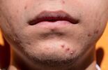 Polecani dermatolodzy w województwie lubelskim (zdjęcie 3)