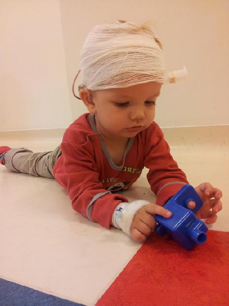 2-letni Kacperek Kochanowski z Międzyrzeca Podlaskiego w sierpniu 2013 r. przeszedł operację wszczep