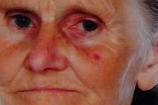 Zaginęła 76-letnia kobieta. Cierpi na zaniki pamięci