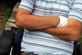 Potrzebna pomoc. Stracił obie nogi, zbiera na protezy