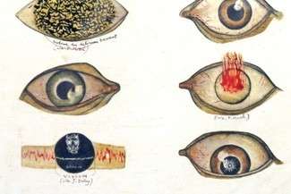 AB/ramowi/CE. Wystawa prac z archiwum Szpitala Neuropsychiatrycznego