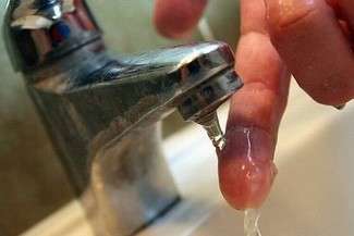 Sochy bez wody. Sanepid znalazł bakterie