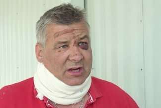 Pan Robert trafił do szpitala przy al. Kraśnickiej