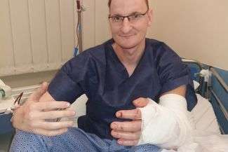 Pan Piotr urodził się bez ręki. Przeszczepili mu ją lekarze. "Wszyscy gratulowali mi odwagi"