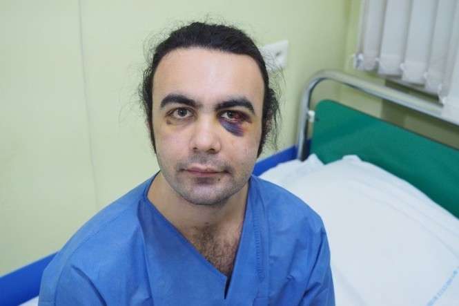 25-latek z Turcji trafił do szpitala z połamanymi kośćmi twarzy. Do tej pory nie udało się ustalić napastników