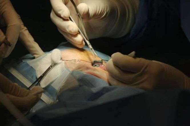 Operacja w Klinice Okulistyki Ogólnej SPSK1 