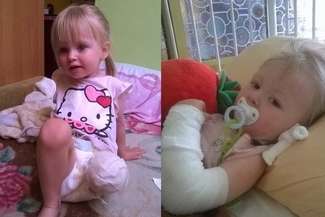 Mała Natalka potrzebuje drogiej rehabilitacji i regularnych wizyt u lekarzy specjalistów. Jej rodzice potrzebują pomocy