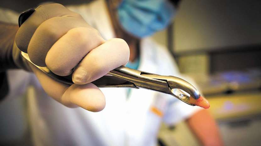 Na usunięcie zęba kazano pacjentowi czekać do stycznia lub zapłacić 100–400 zł