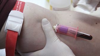 Rejestracja dawców szpiku