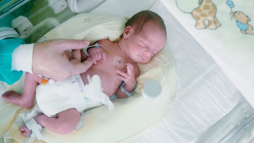 Wcześniaki to dzieci urodzone poniżej 37. tygodnia ciąży. Obecnie m.in. dzięki nowoczesnemu sprzętowi lekarze są w stanie ratować dzieci urodzone powyżej 24. tygodnia życia (to granica przeżycia, mówi się wówczas o skrajnym wcześniactwie). Wcześniakami opiekuje się m.in. klinika przy ul. Staszica w Lublinie, gdzie w wyniku przedwczesnego porodu przychodzi na świat ok. 50 dzieci rocznie (ok. 10 proc. wszystkich porodów). Są wśród nich dzieci ze skrajnie niską masą urodzeniową – nawet poniżej 500 g.<br />
