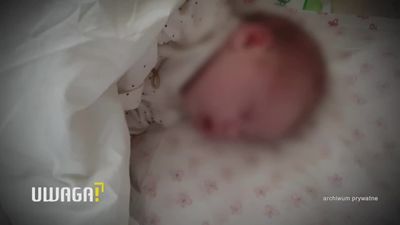 4-tygodniowa dziewczynka trafiła do szpitala ze złamaną kością czaszki, połamaną nóżką i rączką