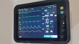 Zdjęcie ilustracyjne