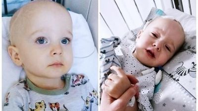 Mały chłopczyk z wielkim guzem. Kosztowna operacja może uratować Filipka 