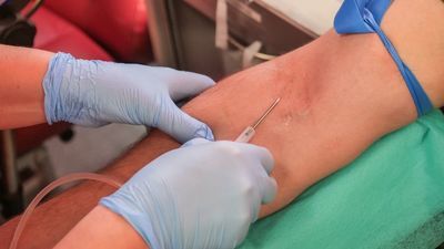 Zakażona ciężarna była w bardzo ciężkim stanie. Po podaniu osocza ozdrowieńca już nie ma objawów choroby