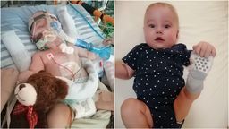 Mały Marcinek z Anusina walczy o życie w klinice w Niemczech. Rodzice zbierają na leczenie