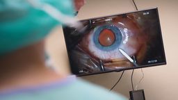 W zakresie klinicznym Uniwersytet Medyczny chce wprowadzać telemedycynę m.in. w okulistyce