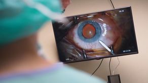 W zakresie klinicznym Uniwersytet Medyczny chce wprowadzać telemedycynę m.in. w okulistyce