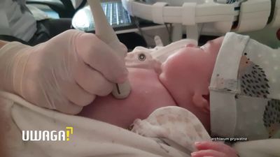 Zero punktów w skali Apgar. Lekarz w Parczewie do rodzącej kobiety: Umiałaś zrobić dziecko? To teraz masz!