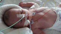 Mała Eliza cierpi na szereg chorób