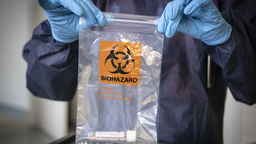 Koronawirus. Cztery ogniska w fazie rozwojowej. Powiat bialski, puławski, łukowski, Lublin