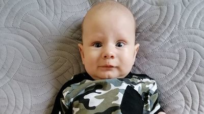 Oliwiera z Chełma czeka 10 operacji, a ma dopiero siedem miesięcy. Ruszyła zbiórka