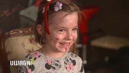 Podczas ataków piszczy z bólu. Pięcioletnia Julia spod Łukowa potrzebuje pomocy