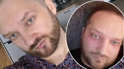 Bartłomiej Borek przed chorobą i w jej trakcie