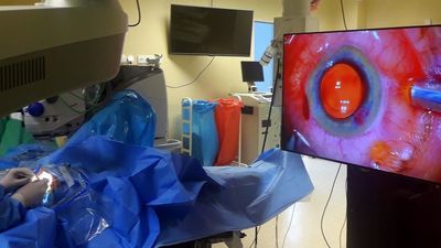 Soboty u okulisty. Będą badać za darmo