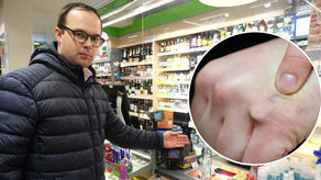 Wojciech Paprota i implant płatniczy w jego dłoni