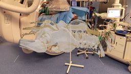 Kosmiczna operacja w Lublinie. Chirurdzy pracowali w specjalnych goglach [wideo]