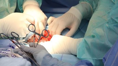 20-letni Artur zmarł po rutynowej operacji. Wyrok na lekarzy z Lublina