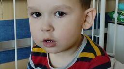 Walka o zdrowie 3-letniego Leona z Lublina. "Grozi mu operacja, jeżeli nic nie zrobimy ze skoliozą"