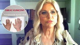 Prof. dr hab. n. med. Beata Matyjaszek – Matuszek kieruje Klinicznym Oddziałem Endokrynologii SPSK Nr 4 w Lublinie