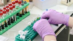 Zdjęcie ilustracyjne