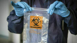 Lubelskie. Niemal najwięcej zachorowań w Polsce