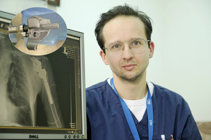 Dr n. med. Tomasz Gieroba i wydrukowany implant