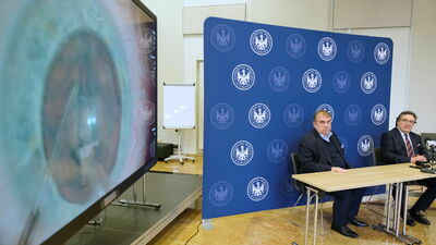Nowoczesny sprzęt do operacji okulistycznych w technice 3D za około pół miliona złotych kupił Uniwersytet Medyczny.