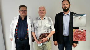 Pacjent, pan Roman (w środku) z lekarzami z lubelskiego SPSK 1: prof. Tomaszem Zubilewiczem i dr Tomaszem Pedowskim. Na zdjęciu w ramce brzuch z widocznym tętniakiem oraz podczas operacji