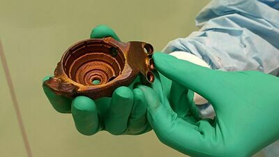 Proteza z drukarki 3D. Tak operują lekarze z Lublina