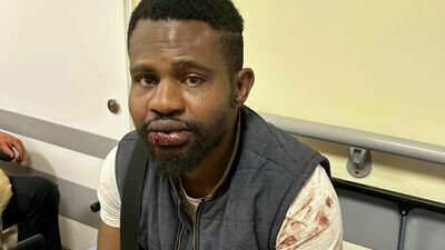 Brutalny atak w Lublinie. Bili, kopali, skakali po głowie "Skoro jest czarny..."