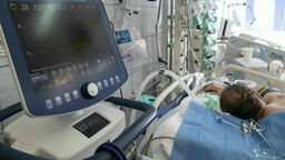 Na legionelozę zachorowało 157 osób, a 18 zmarło