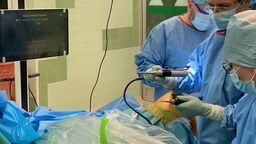 Urządzenie tworzy trójwymiarowy obraz kości w trakcie operacji