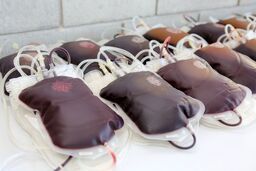 Bezpłatne warsztaty dla chorych na nowotwory krwi i szpiku