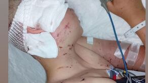 Po wypadku Piotrek trafił do szpitala w Hrubieszowie, później przewieziono go do szpitala, gdzie przeszedł poważną operację. Wymaga dalszego leczenia