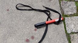 Prowizoryczny opatrunek uratował życie 20-latki